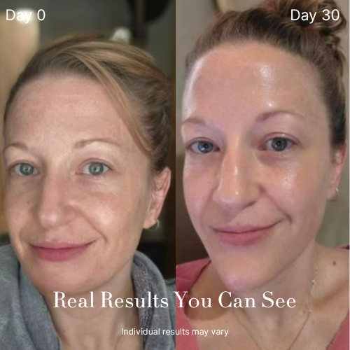 Blisel™ - Bio-Collagen Mask