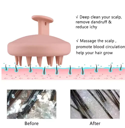 Blisel™ - Silicone Scalp Brush