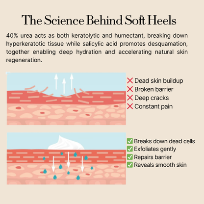 Blisel™ - Urea Cream